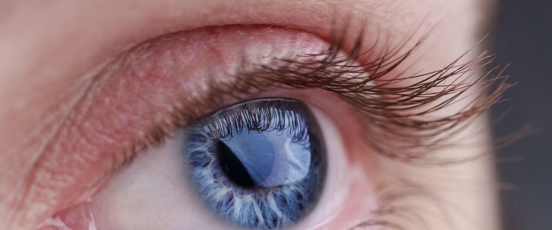 What are the Risks and Side Effects of LASIK Eye Surgery?