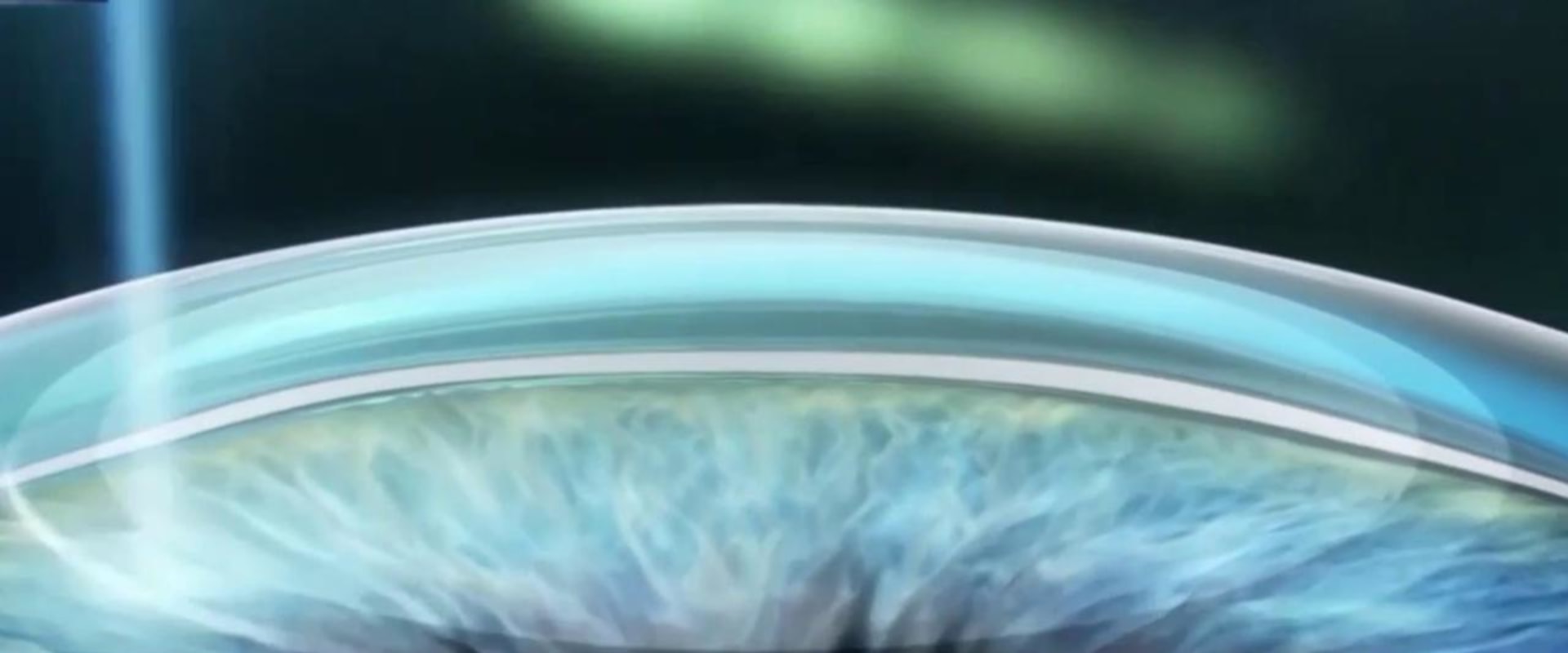 How Common is Undercorrection in LASIK Surgery?