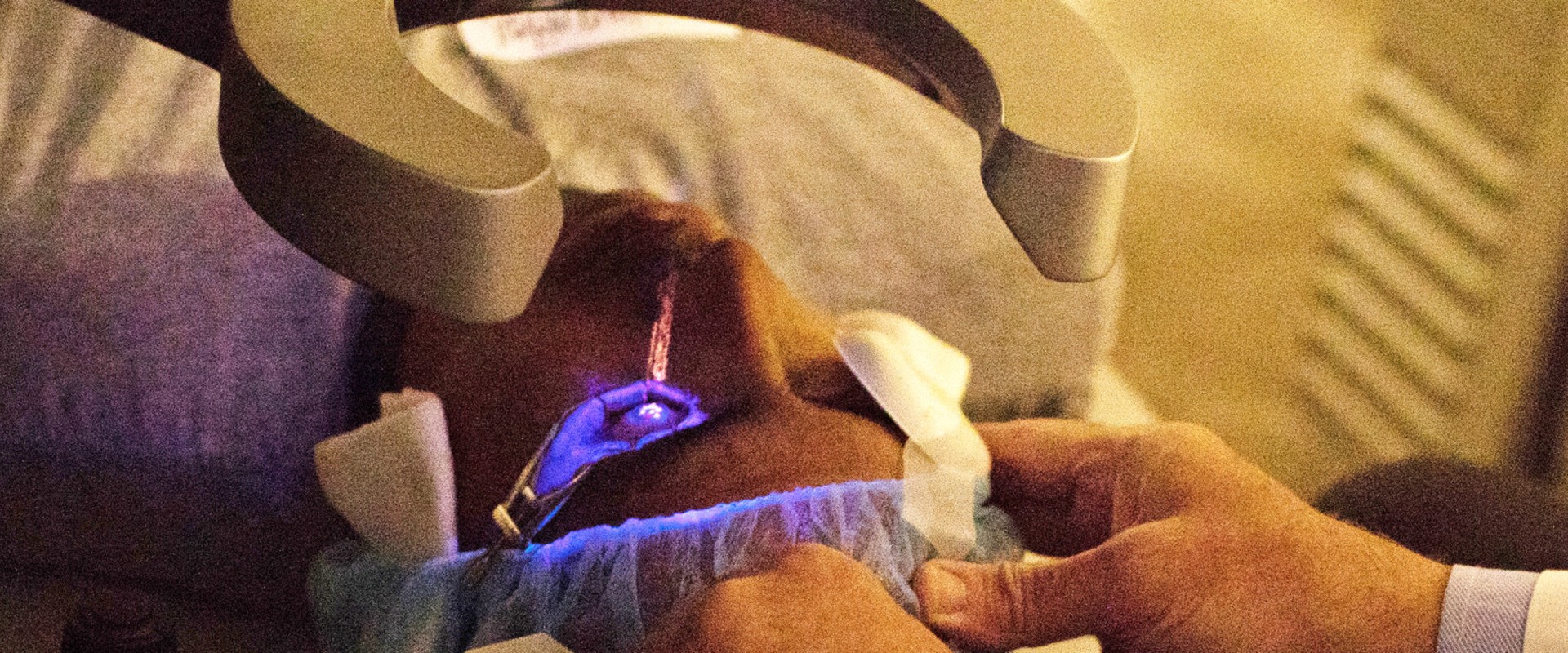 What are the downsides of lasik?