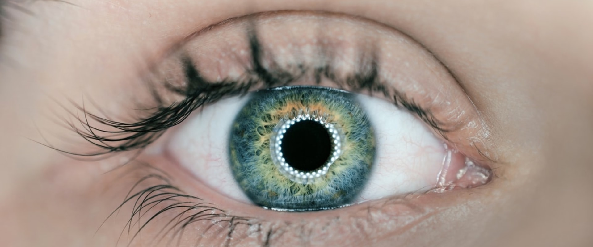 What are the Chances of LASIK Surgery Failing?
