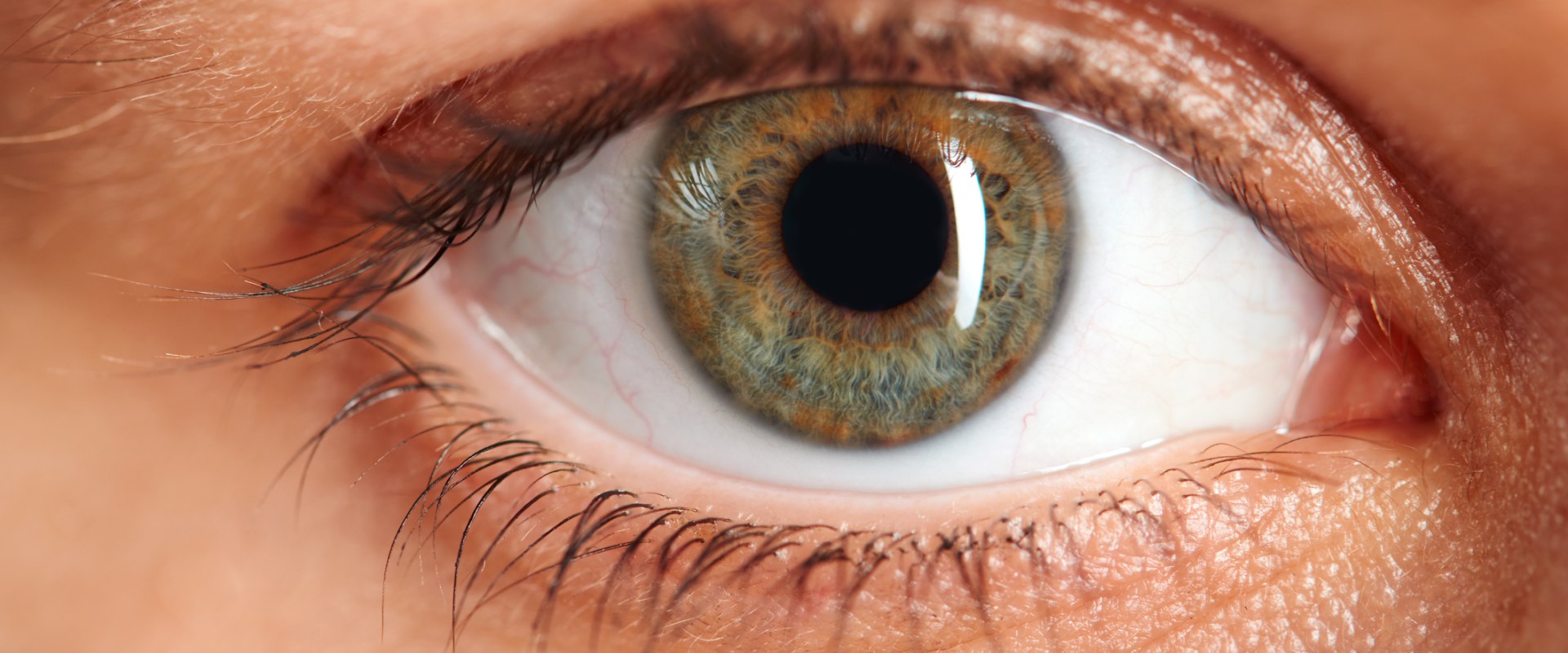 Laser Vision Correction for People with High Levels of Astigmatism