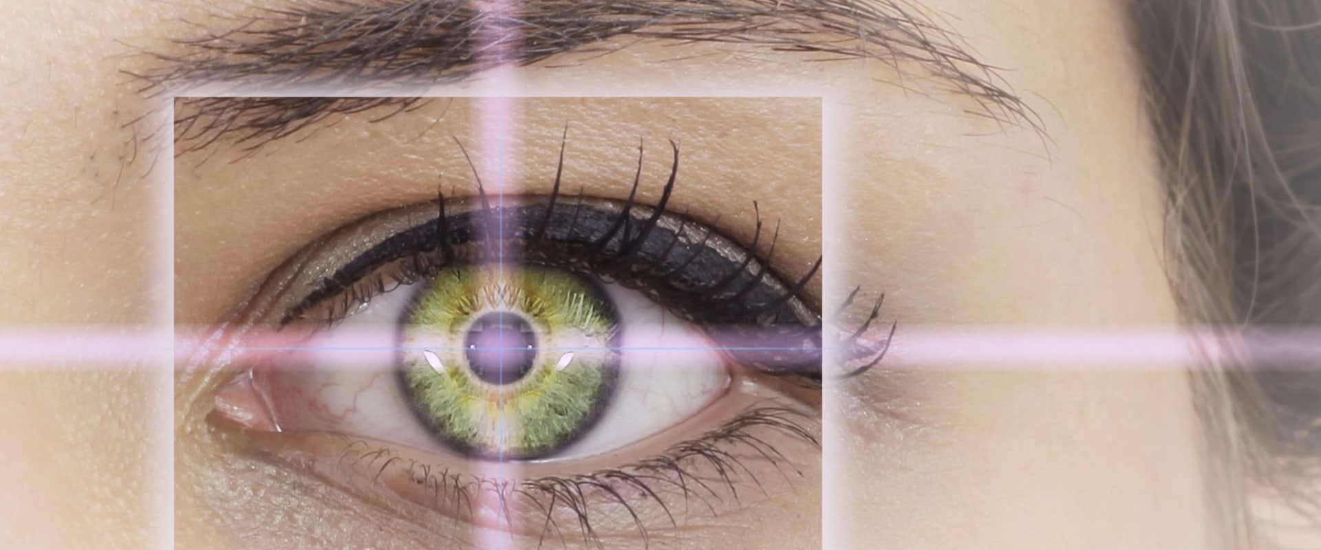 Does LASIK Surgery Last a Lifetime?