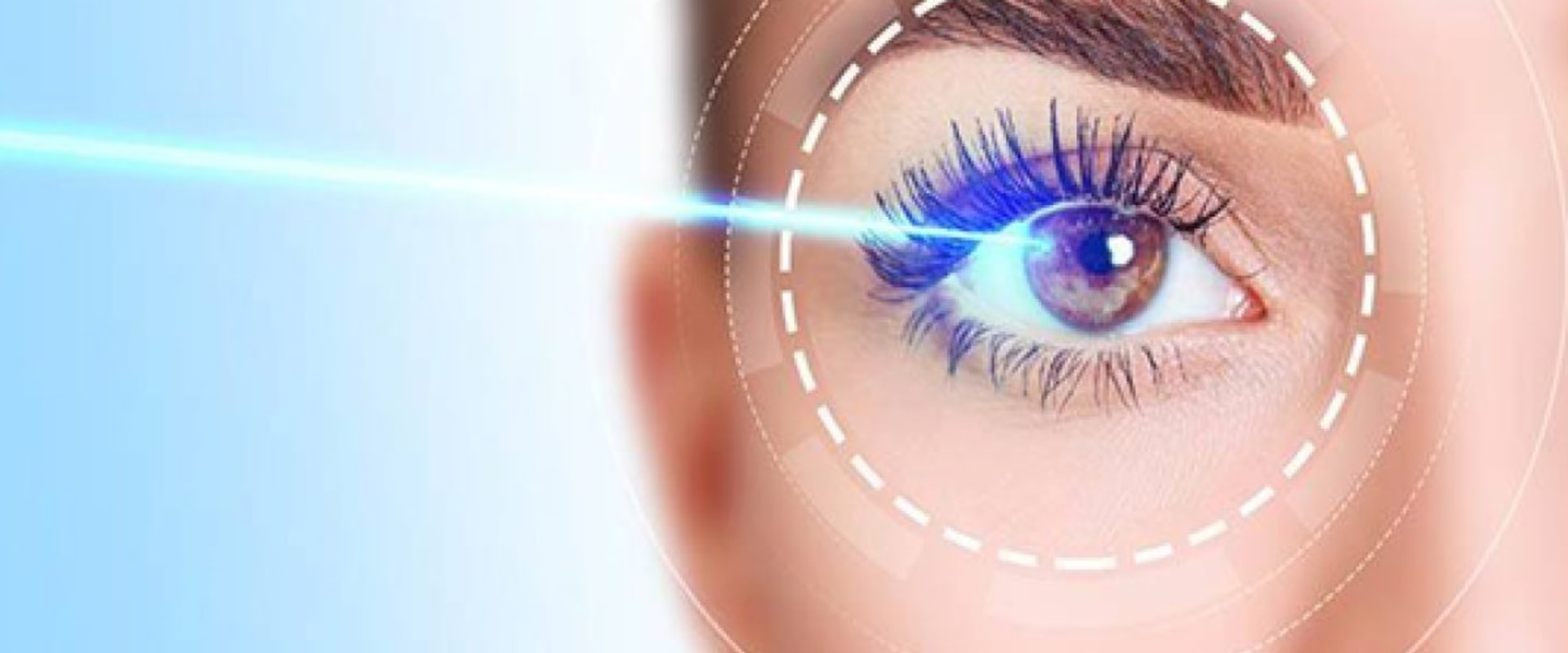 How to Prevent Vision Regression After Lasik Surgery