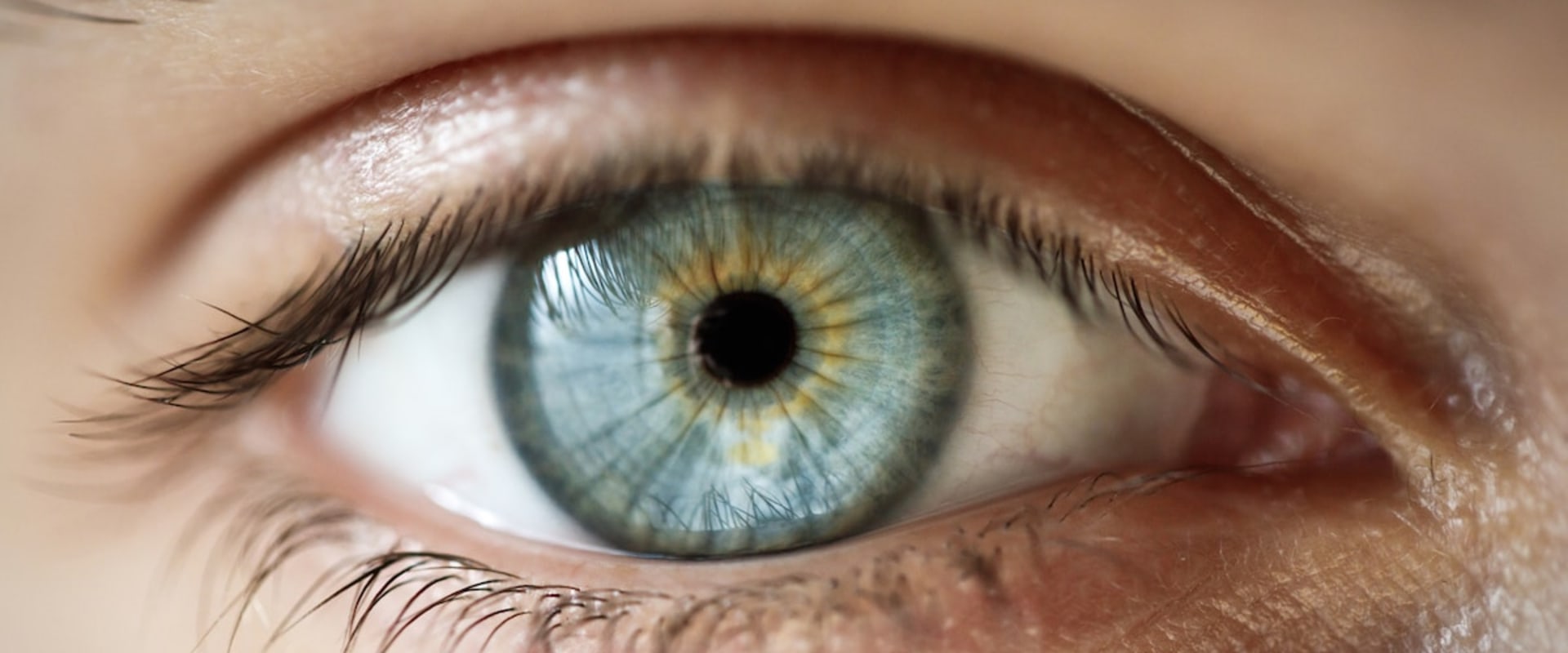 What Conditions Disqualify You from LASIK Surgery?