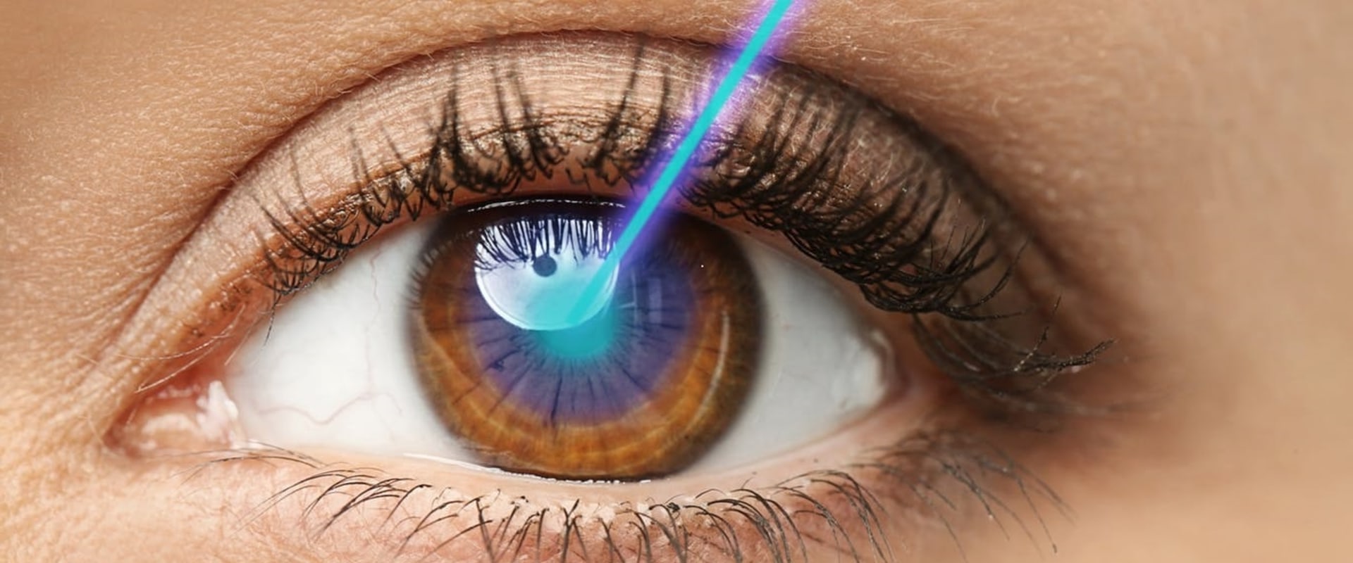 Can you get lasik while on antidepressants?