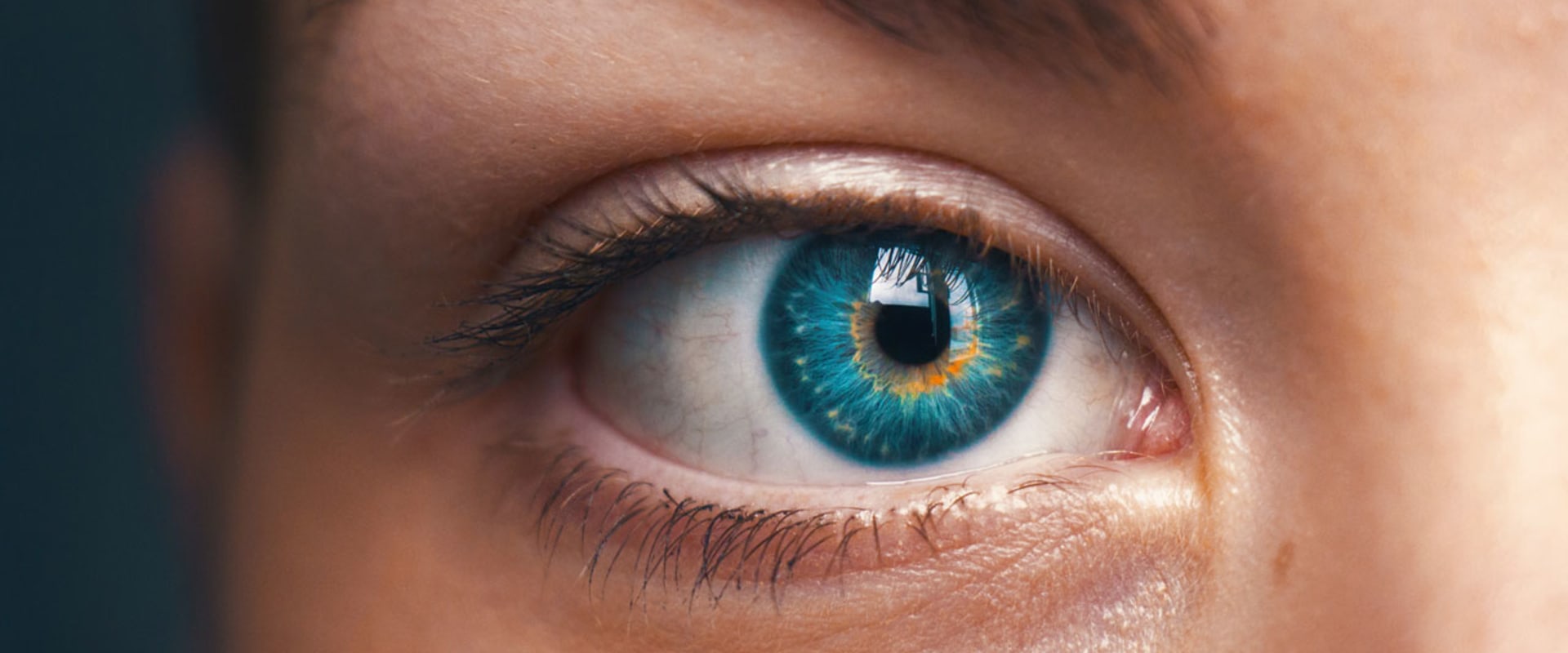What is the astigmatism limit for lasik?