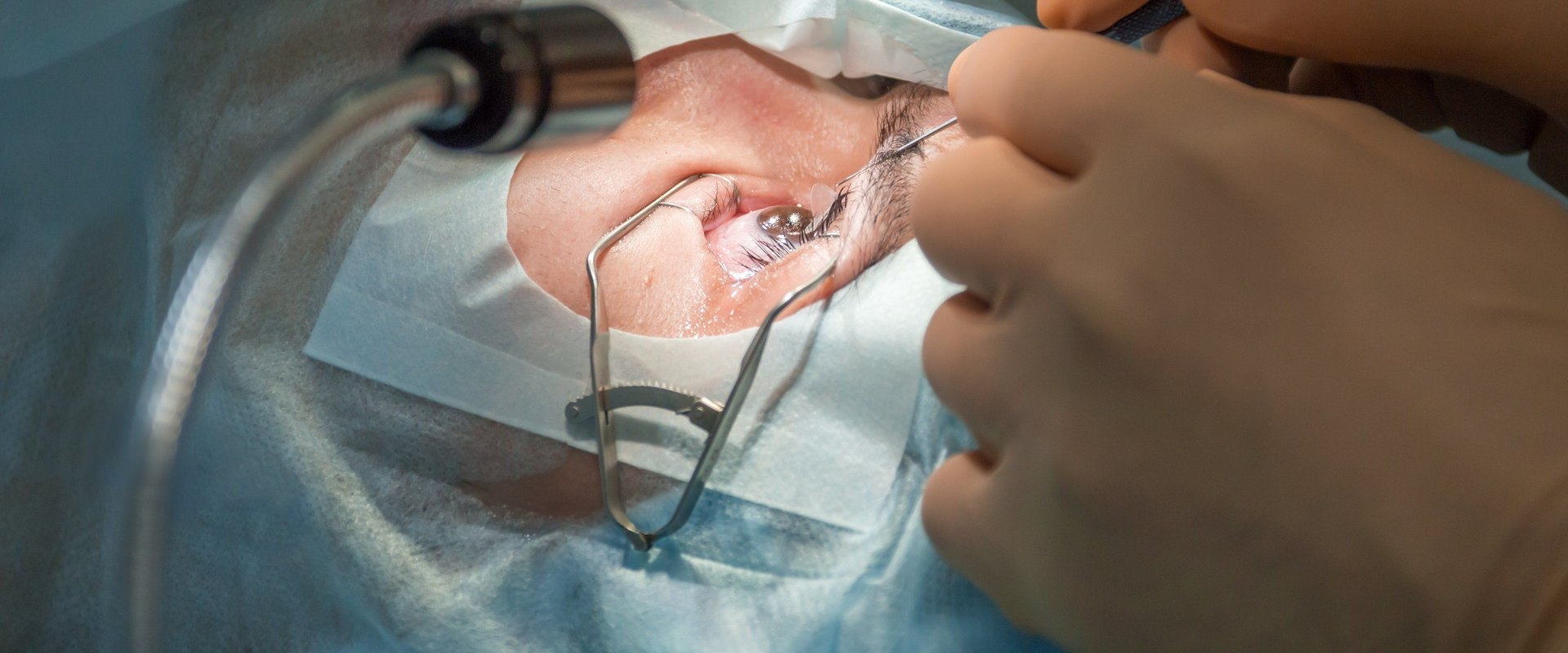 Can I Be Put to Sleep for LASIK Surgery?