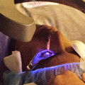 What are the downsides of lasik?