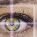Does LASIK Surgery Last Forever?