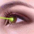 Can I Have Both Eyes Done at the Same Time with LASIK Eye Surgery?