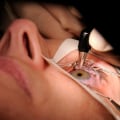 Is LASIK Surgery Worth It After 50?