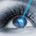 Which is cheaper prk or lasik?