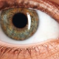 Laser Vision Correction for People with High Levels of Astigmatism