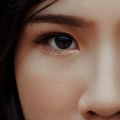 Can You Blink During LASIK Surgery?