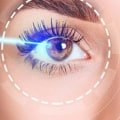 How to Prevent Vision Regression After Lasik Surgery