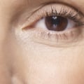 What Are the Age Restrictions for LASIK Eye Surgery?