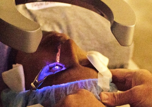 What are the downsides of lasik?