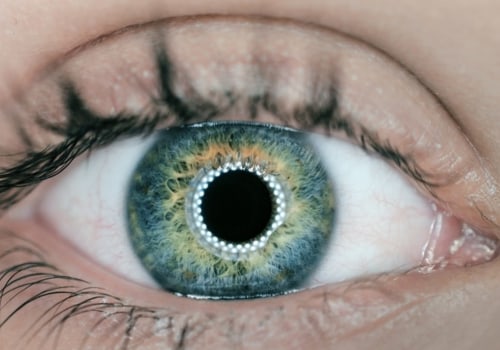 How Long Does Night Blindness Last After LASIK Surgery?