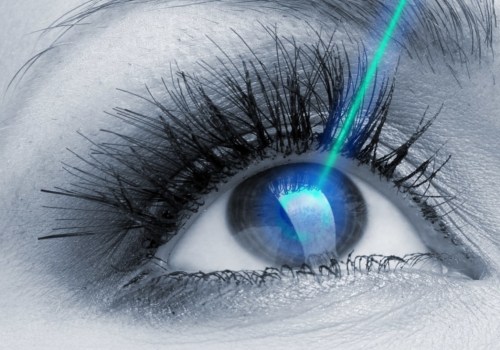 Which is cheaper prk or lasik?