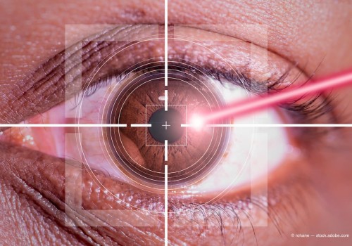 Is Lasik Surgery High Risk? An Expert's Perspective