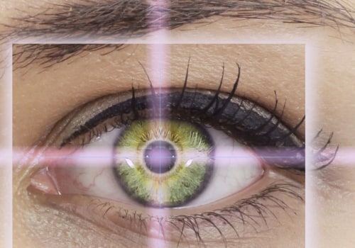 How Long Does it Take to See Results from LASIK Eye Surgery?