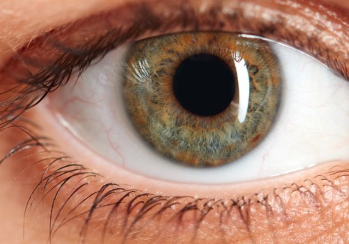 Can you get lasik in your 30s?