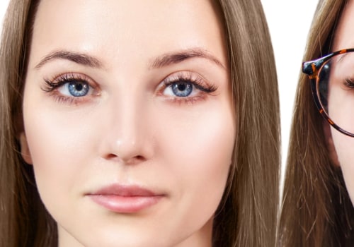 Is LASIK Surgery Worth It? An Expert's Perspective