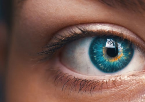 What is the astigmatism limit for lasik?